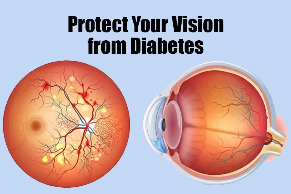 best eye hospital in Lucknow for Ocular Surface Infections , Susanjeevani Hospital